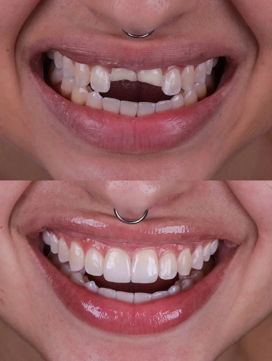 devolvendo_um_lindo_sorriso_voc_s_j_viram_esta_hist_ria_aqui_malu_sofreu_um_acidente_de_c_1